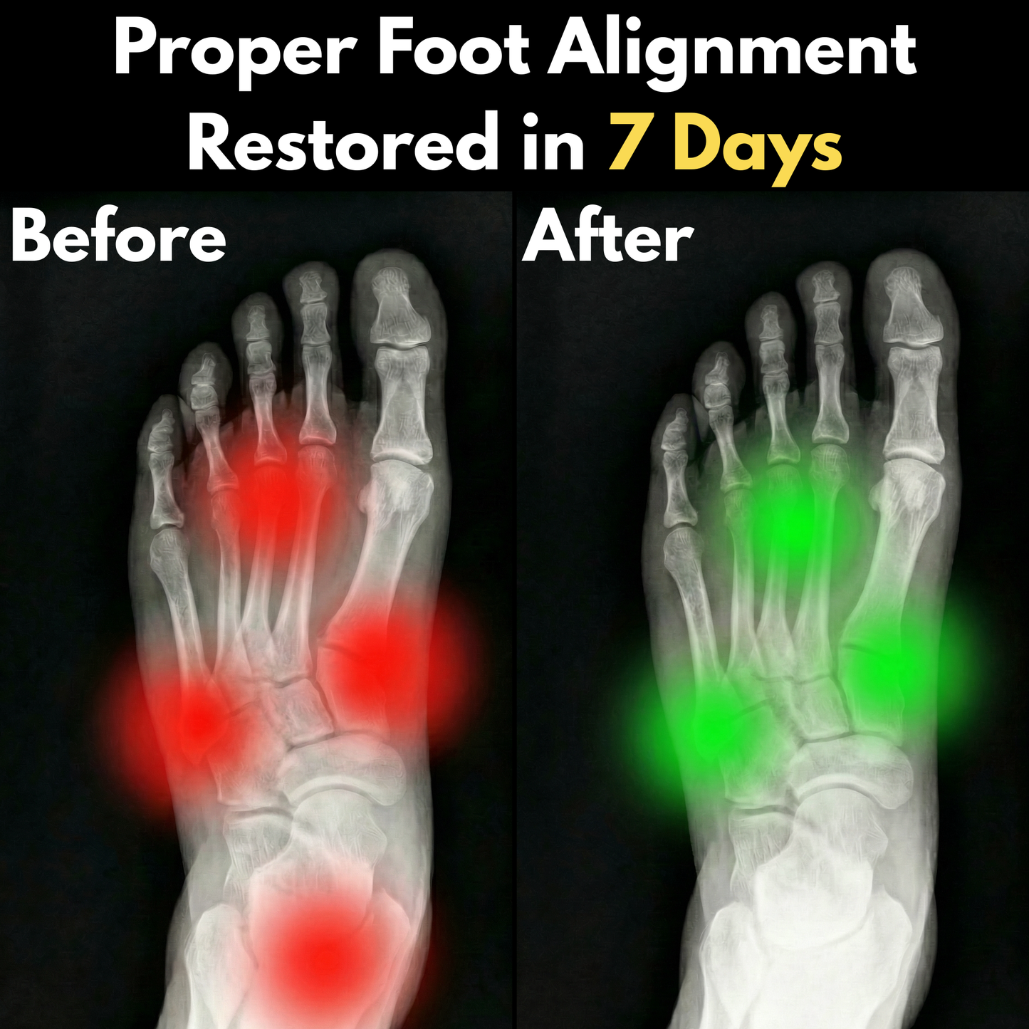 FootAlign™ Relief Sleeve